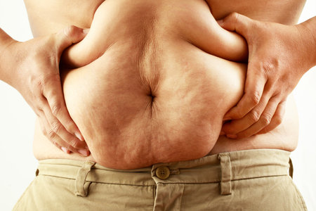 Fat man has excess fat, he is dieting and losing weight.の写真素材