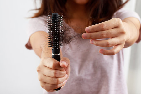 young woman worried about Hair loss problem after comb in hand. problem hormonal disbalance, stress concept. Health care conceptの写真素材