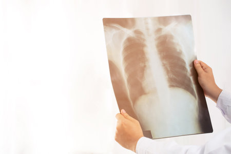 X-ray of the lungs is where X-rays are directed into a part of the chest or lungs where the radiograph images are recorded on film. which the doctor will use to diagnose the integrity of the internal organs, including the chest and lungsの写真素材