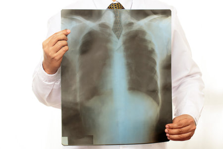 Doctor reads pneumonia test results from X-ray filmの写真素材
