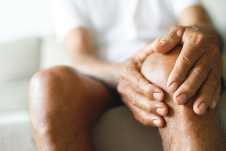 Osteoarthritis is more common in the elderly. Causes knee pain, swelling, redness, stiffness in the knee, clinging noise in the knee.の写真素材