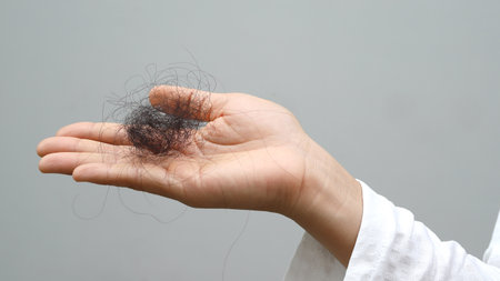 Woman with hair loss dryness and frizzinessの写真素材