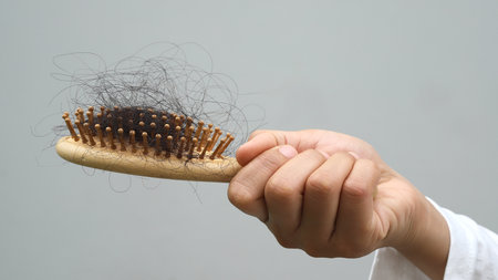 Woman with hair loss dryness and frizzinessの写真素材