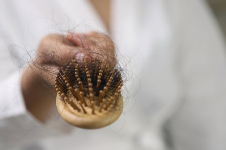 Women with hair loss dryness and frizzinessの写真素材