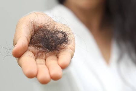 Women with hair loss dryness and frizzinessの写真素材