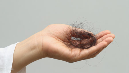 Woman with hair loss dryness and frizzinessの写真素材
