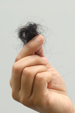 Woman with hair loss dryness and frizzinessの写真素材