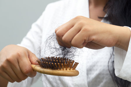 Women with hair loss dryness and frizzinessの写真素材