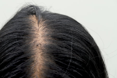 Women with hair loss dryness and frizziness.の写真素材