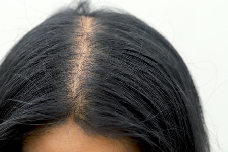 Women with hair loss dryness and frizziness.の写真素材