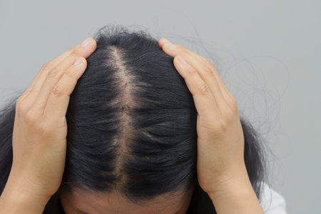 Women with hair loss dryness and frizziness.の写真素材