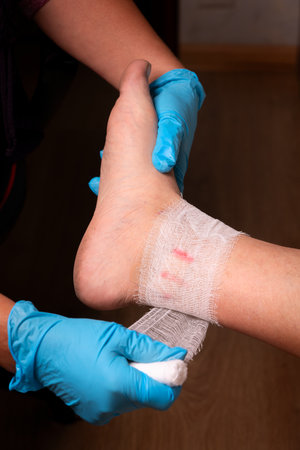 Bandage on the foot of a woman in a medical office.