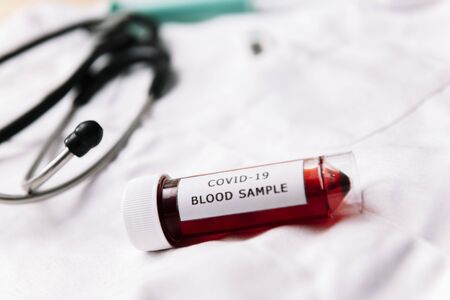 vial with a blood sample infected with covid-19, health and medicine concept, selective focus, copy space for textの写真素材