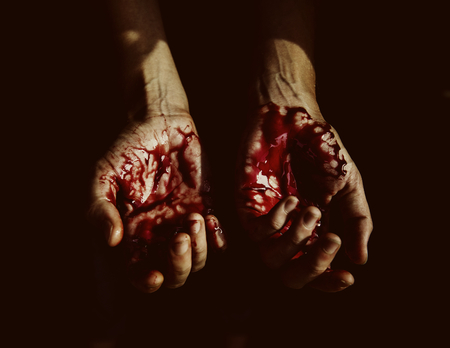 Bloody hands