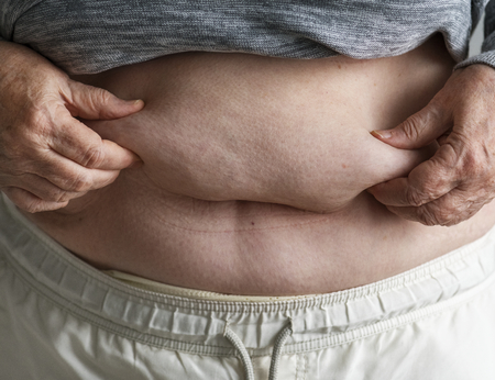 Closeup of obese elderly woman