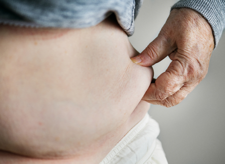 Closeup of obese elderly woman