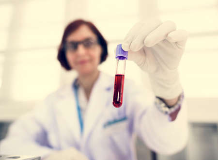 Doctor holding blood sample