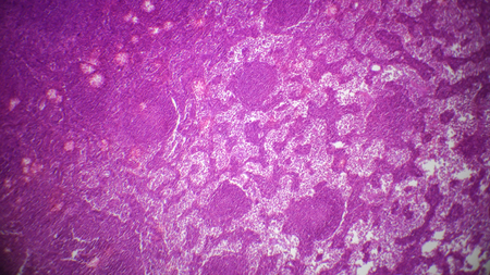 Lymph node section under the microscopeの写真素材