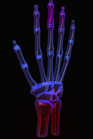 3d human hand pain	の写真素材