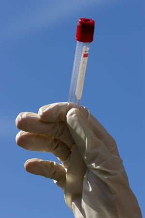 blood analyses
