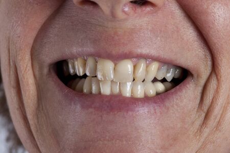 mouth of an oder womanの写真素材