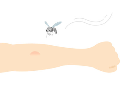 Illustration of insect bitesのイラスト素材