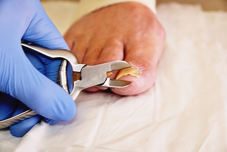Close-up of a manicurist with pedicure pliers trimming old person toenail. Pedicurist with nail clippers makes pedicureの写真素材