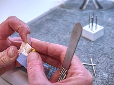 Dental prosthetics hands working on the denture, false teeth, a study and a table with dental toolsの写真素材