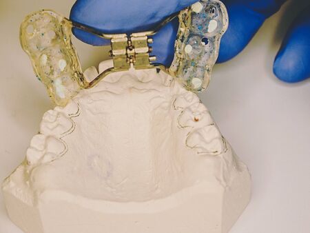 Dentist make measurement of dental braces.  Retainer adjustable steel  braces on gypsum copy of...