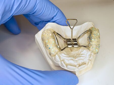 Dentist setting in fingers patient teeth model with Hyrax Expander braces known as rapid palatal expanderの写真素材