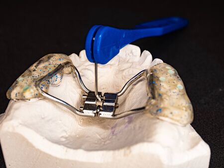 Dentist test setting of palatal braces for young patient. Jaw correction in youth is very popular correction of congenital defectsの写真素材