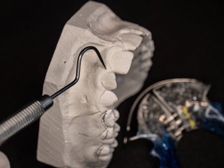 Dental gypsum models and dental brace. Dental Blue Removable Brace or Retainer for upper platal...
