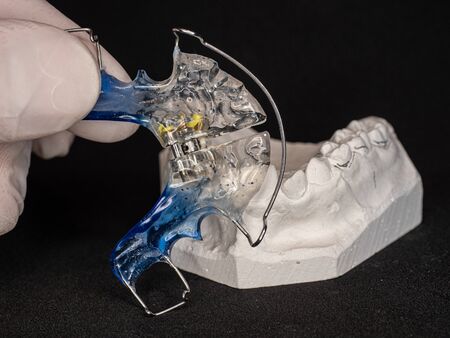 Comparison of blue acrilic tooth retainer for orthodontic correction of jaw with gypsum upper...