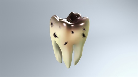  The bad of tooth for remind the tooth care concept の写真素材