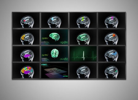 many cctv signal showing on the medical monitor display, it is representing the xray of brainの写真素材