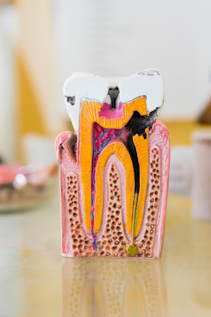 Anatomy model teeth with nerve and root canal, closeup. Dental care and oral hygiene concept....