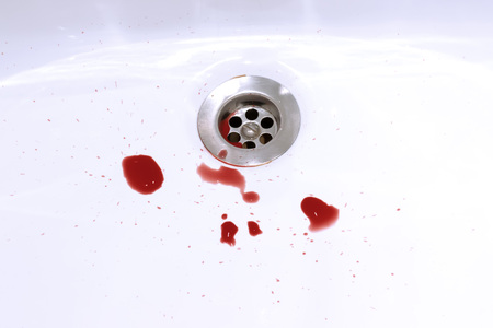 Blood stains in the bathroom sink, bleeding, criminal and suicide concept.