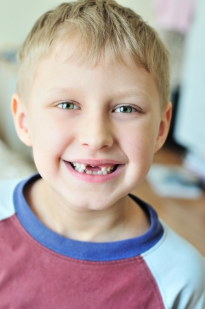 little boy showing that he lost  milk toothの写真素材