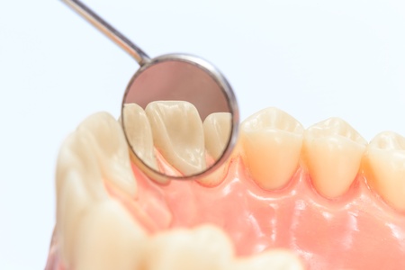 Dentures with a mirrorの写真素材