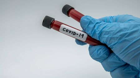 Laboratory technician hand hold on blood sample tube for corona virus test , COVID-19. Scientist with blue gloves for protection. Vaccine research for the 2019-nCoVの写真素材