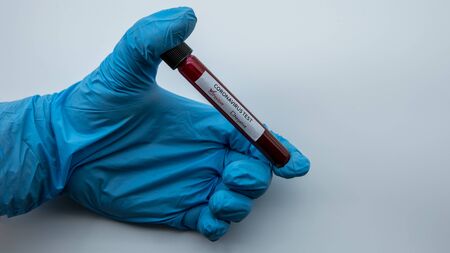 Healthcare to aid recovery from COVID-19. Surgical gloves with a positive coronavirus infected blood sample test. Hand of scientist doctor biohazard protection clothingの写真素材