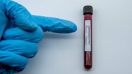 Laboratory technician hand hold on blood sample tube for corona virus test , COVID-19. Scientist...