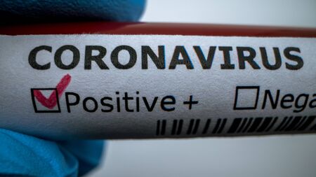 Positive COVID-19 test and laboratory sample of blood testing for diagnosis new Corona virus infection.の写真素材
