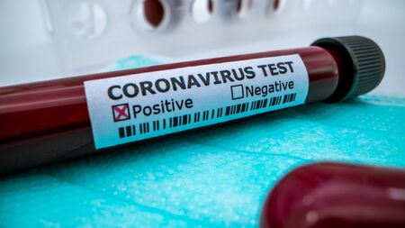 Protective mask and positive COVID-19 test.