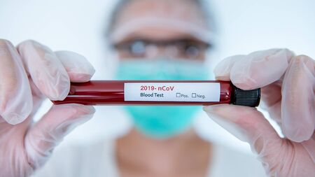 Healthcare to aid recovery from COVID-19. Scientist wear surgical gloves and mask with a coronavirus infected blood sample test. Asian woman doctor biohazard protection clothingの写真素材