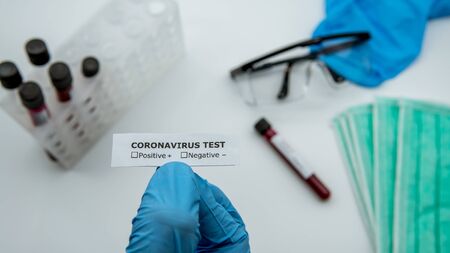 Scientist with blue gloves hold identifier sticker for test tube with infected blood sample for...