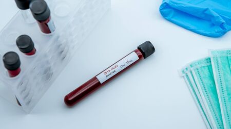 Coronavirus Covid 19 infected blood sample in tube. Vaccine research of virus 2019-nCoV at laboratory.  Pandemic infectious conceptの写真素材