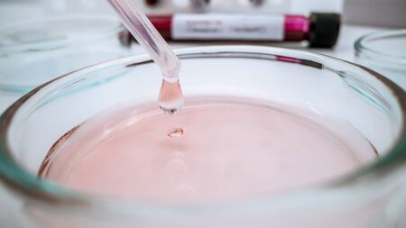 Scientist dropping a sample into a Petri dish. Experimented in laboratory with pipette adding fluid of biochemistry tests medical testing. Equipment and science experiments at lab petrischalenの写真素材