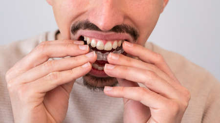 Caucasian young man adjusting and placing an invisible silicone aligner for dental correction. Male...