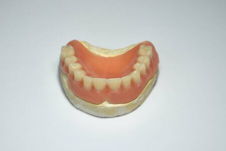 Dentures and various elements of a dental prosthesis for dentists and dental prostheses.